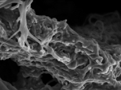 Chitosan bioelectrode sustains metabolic power to medical implants