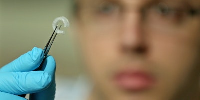 Cartilage to repair tracheal damage created with 3D printer
