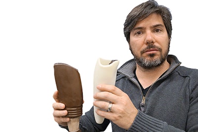 3D printed prosthetic legs for Ugandan children