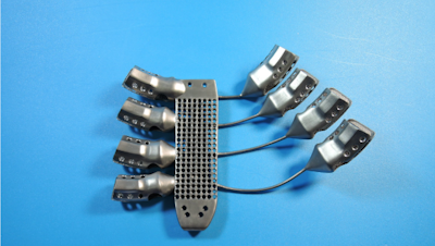 Cancer patient receives 3D printed ribs in world-first surgery