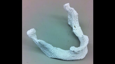 3-D printed bone with just the right mix of ingredients