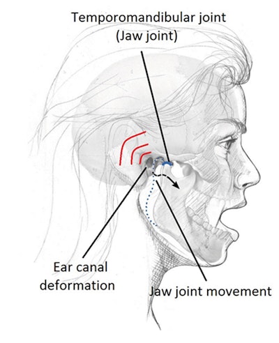 Energy harvesting from jaw movement to power hearing aids