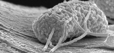 Wired microbes generate electricity from sewage