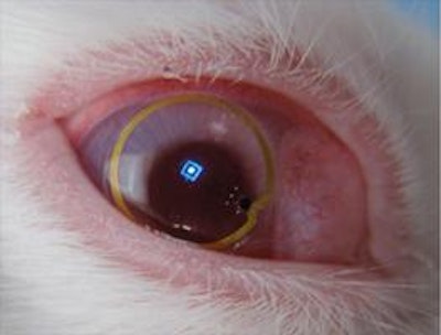 Progress with energy harvesting contact lens displays