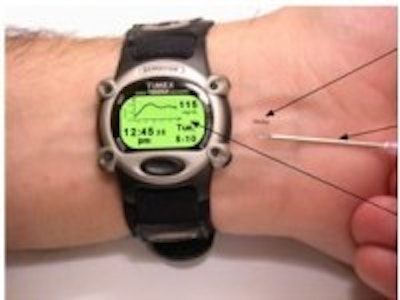Solar powered implanted glucose monitor for diabetics