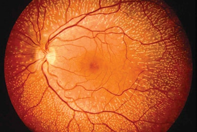 First self-powered artificial retina
