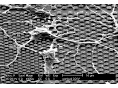 IMEC's unique micronail chip makes electronics, bio cells communicate