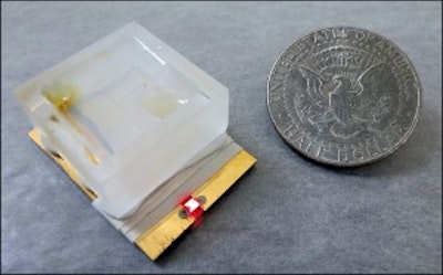Self powered sensor detects pancreatitis