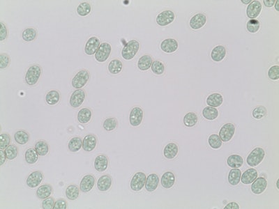 Cyanobacterial genes that capture the sun's energy