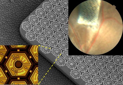 Solar retinal implants may restore sight to the blind