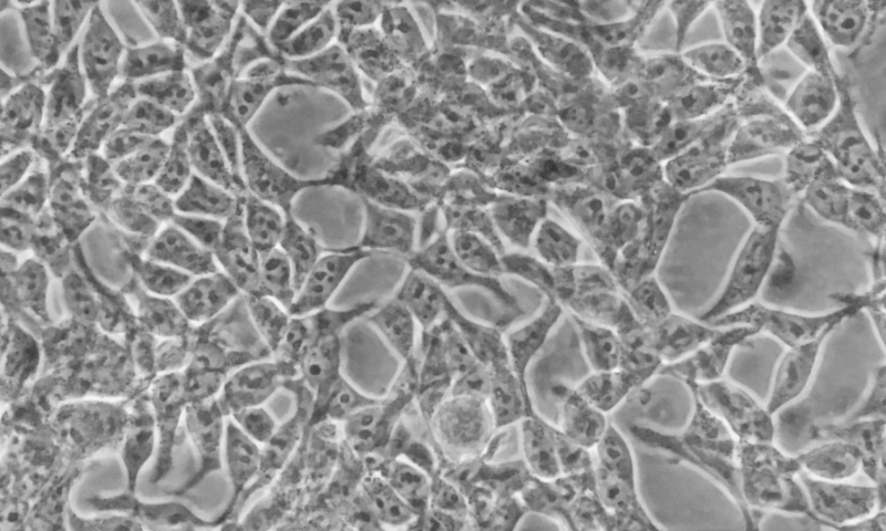Live cell imaging using a smartphone