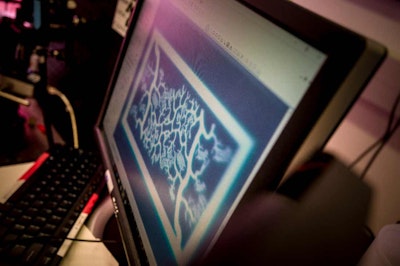 Blood vessel network that could pave the way toward artificial organs