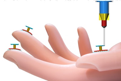 3D-printed bionic skin could give robots the sense of touch