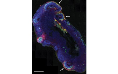 A bioengineered upgrade for organoids