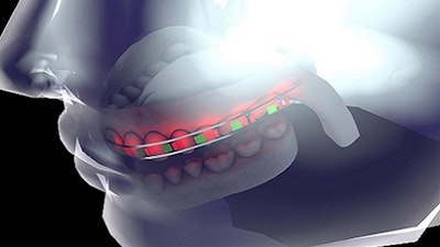Flexible batteries for smart dental aids