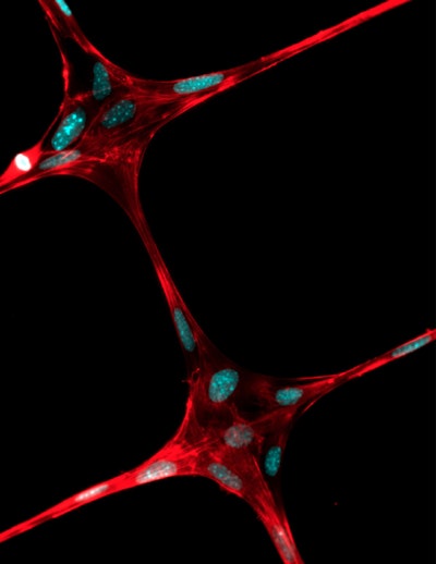 3-D printed microfibers could aid artificially grown body part