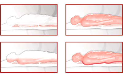 First disposable conductive ink patient warming system