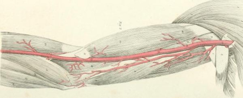 3D bioprinting artificial blood vessels, organs