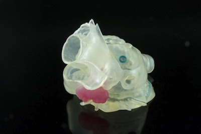 Stratasys and Materialise: 3D printed medical models come to life