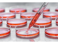 Growing skin in the lab for the treatment of advanced wounds