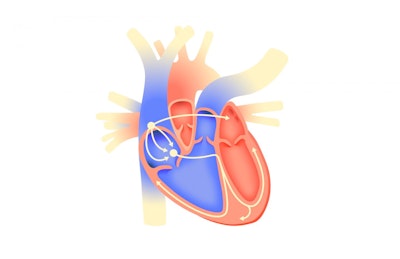 3D-print system for optical cardiography