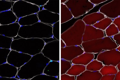 Editing genes at the source