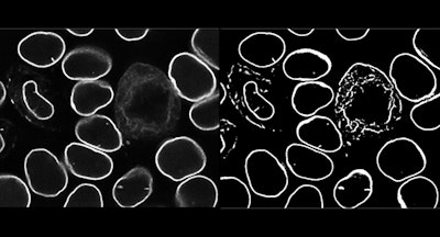 Machine learning lets biologists navigate their way through a 3D cell
