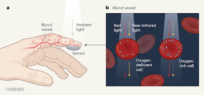 Wearable Graphene Sensors Use Ambient Light to Monitor Health