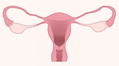 Step Toward 'Ink' Development for 3D Printing a Bioprosthetic Ovary