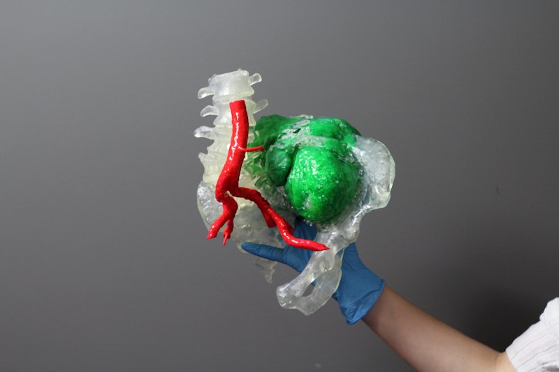 Partnership to Bring 3D Printing to Hospitals in South Africa
