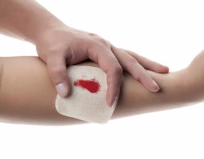 3D Bioprinted Patches Use Pectin to Heal Wounds