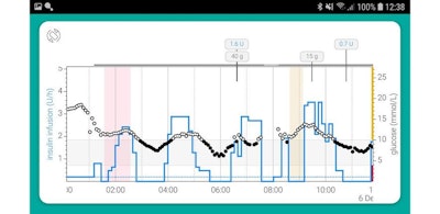 World's First Artificial Pancreas app Licensed for Type 1 Diabetes