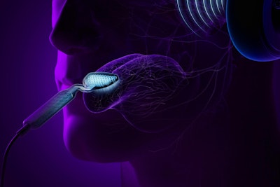 Treating Tinnitus with Electrical Stimulation