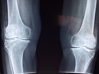 Bioprinted Hybrid Tissue for Cartilage Regeneration