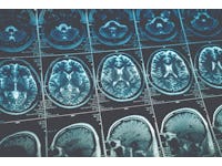Join the IDTechEx Webinar on AI in Medical Diagnostics (With Q&A)