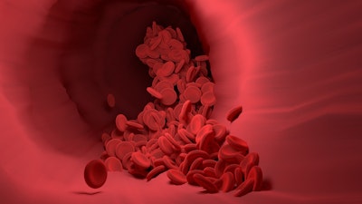 Liquid Bandage Detects Tissue Oxygenation Without Wired Oximeters