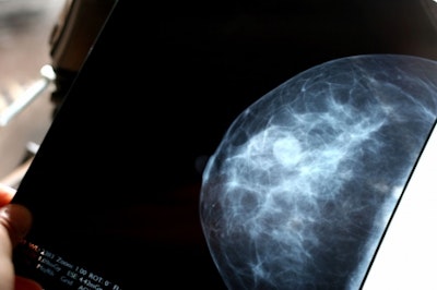 Using AI to Hunt for Breast Cancer