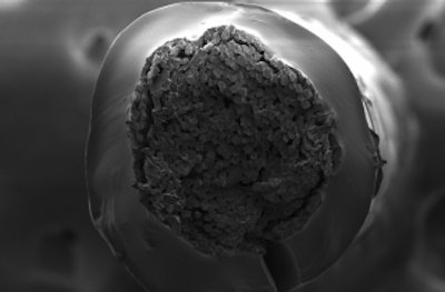 Surgical Sutures Inspired by Human Tendons