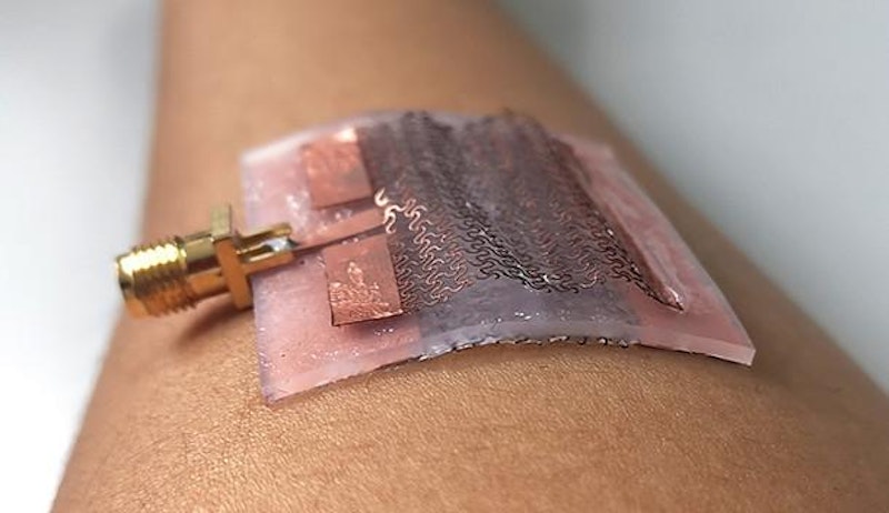 Stretching the Boundaries of Medical Tech with Wearable Antennae
