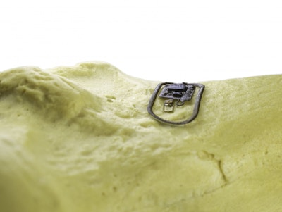 Ultra-Thin 'Computer on the Bone' Monitors Bone Health