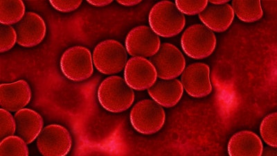 3D Printing of Blood Plasma May Speed up Wound Healing