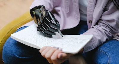 Advanced Graphene Foam Sensors Could Transform Prosthetics