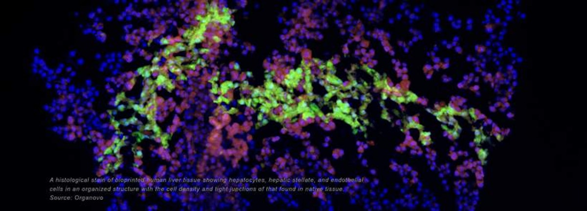 Challenges on the road to 3D bioprinted organs