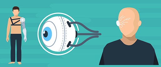 Neuroprosthetics: Re-engineering sound, sight, and touch